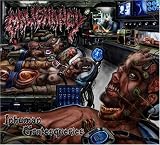 Malignancy
