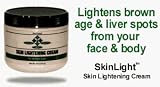 SkinLight Skin Lightening Cream bleaches skin removes vitilgo moles birthmarks freckles