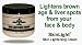   - SkinLight Skin Lightening Cream bleaches skin removes vitilgo moles birthmarks freckles