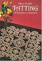 Tatting: Technique and History