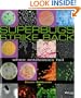 Superbugs Strike Back: When Antibiotics Fail (Discovery!)