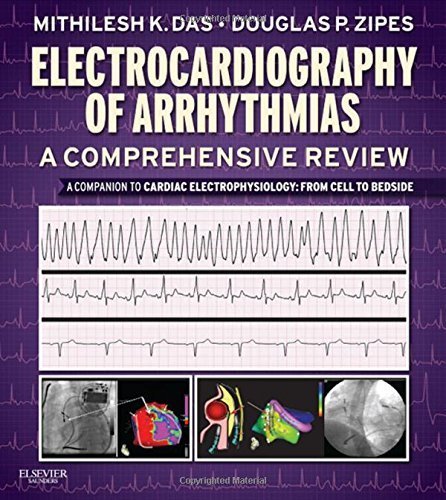 Electrocardiography of Arrhythmias: A Comprehensive Review: A Companion to Cardiac Electrophysiology, 1e by Mithilesh Kumar Das MD (2012-04-12)