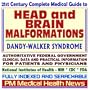 21st Century Complete Medical Guide to Head and Brain Malformations: Dandy-Walker Syndrome, Cephalic Disorders--Authoritative Government Documents, ... Information for Patients and Physicians