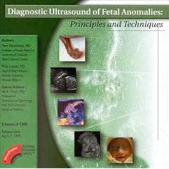 Diagnostic Ultrasound of Fetal Anomalies: Principles and Techniques (CD-ROM for Windows & Macintosh, Individual Version)