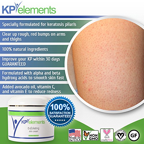 KP Elements Keratosis Pilaris Treatment Cream Keratosis Pilaris Cream