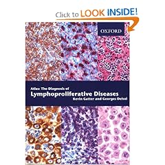 The Diagnosis of Lymphoproliferative Diseases: An Atlas by Kevin Gatter and Georges Delsol