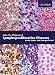 Books : The Diagnosis of Lymphoproliferative Diseases: An Atlas