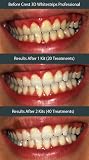 Crest 3D White Whitestrips With Advanced Seal Professional Effects Enamel Safe Dental Whitening Kit, 20-count box