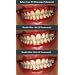 Crest 3D White Whitestrips With Advanced Seal Professional Effects Enamel Safe Dental Whitening Kit, 20-count box