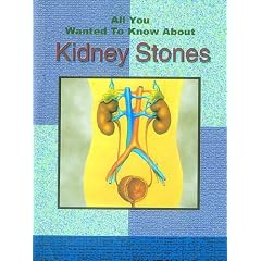 All You Wanted to Know About Kidney Stones