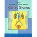 All You Wanted to Know About Kidney Stones