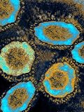Sars Coronavirus Composite Severe Acute Respiratory Photographic Poster Print, 12x16