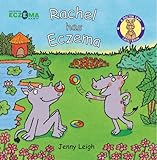 Rachel has eczema