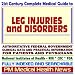 21st Century Complete Medical Guide to Leg Injuries and Disorders: Authoritative Government Documents, Clinical References, and Practical Information for Patients and Physicians