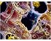Photographic Print of False-colour SEM of liver cells with cirrhosis from Science Photo Library