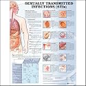 Sexually Transmitted Infections Anatomical Chart