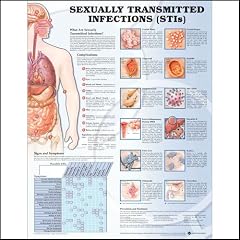 Sexually Transmitted Infections Anatomical Chart by Anatomical Chart Company