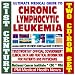 21st Century Ultimate Medical Guide to Chronic Lymphocytic Leukemia (CLL) - Authorita...