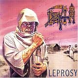 Leprosy