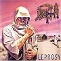 Leprosy