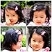 Bundle Monster 18pc Ribbon Bow Flower Mixed Design Baby Girl Toddler Hair Clip