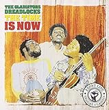 Dreadlocks the Time Is Now