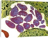 Box Canvas Print of Toxoplasmosis from Science Photo Library