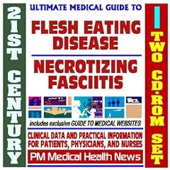21st Century Ultimate Medical Guide to Flesh-Eating Disease (Necrotizing Fasciitis) Group... by PM Medical Health News