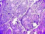 Pituitary Gland Endocrine Gland Hormone Photographic Poster Print, 16x12