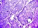 Pituitary Gland Endocrine Gland Hormone Photographic Poster Print, 16x12
