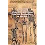 Astrological Judgement of Diseases from the Decumbiture of the Sick