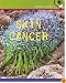 Skin Cancer (Health Alert)