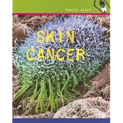 Skin Cancer (Health Alert)
