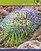 Books : Skin Cancer (Health Alert)