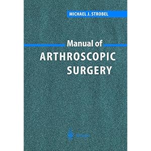 Manual of Arthroscopic Surgery