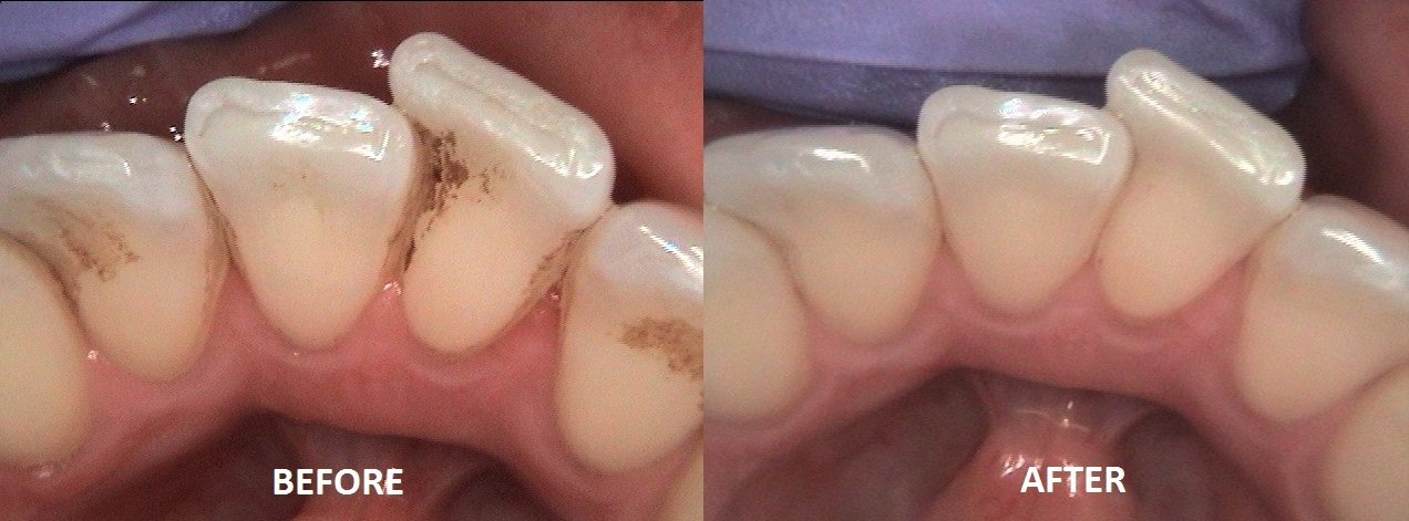 Amazon.com: DBPOWER® MD740 USB 2.0 Connection, 6 Led, Max 3.8 Mega ... Amazon.com: DBPOWER® MD740 USB 2.0 Connection, 6 Led, Max 3.8 Mega ...