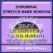 Subliminal Stretch Mark Removal