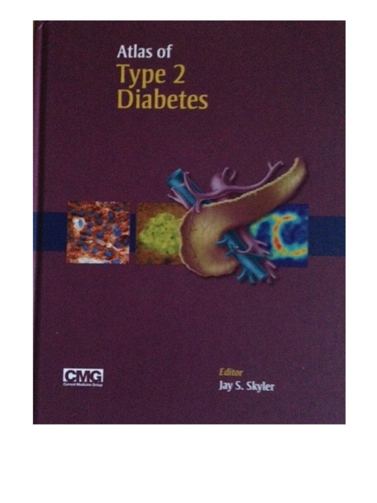 Atlas of Type 2 Diabetes: 9781573403535: Medicine & Health Science ... Atlas of Type 2 Diabetes: 9781573403535: Medicine & Health Science ...