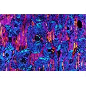 Photographic Prints of Compact bone, light micrograph from Science Photo Library