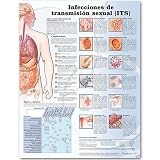 Sexually Transmitted Infections Anatomical Chart in Spanish (Infecciones de transmision sexual)
