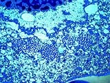 Cytomegalovirus Particles Lung Biopsy AIDS Patient Photographic Poster Print, 32x24