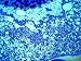 Cytomegalovirus Particles Lung Biopsy AIDS Patient Photographic Poster Print, 16x12