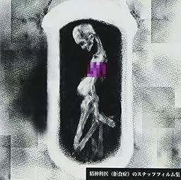 精神科医(拒食症)のスナッフフィルム集 <初回限定盤>
