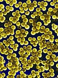 Methicillin Resistant Staphylococcus Aureus, MRSA Photographic Poster Print, 18x24