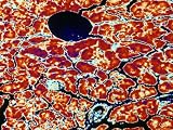 Pancreas Exocrine Tissue with Acinal Epithelium X400 Photographic Poster Print, 32x24