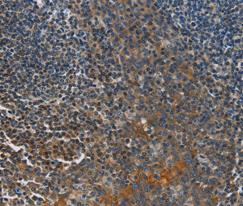 CACNB1 Polyclonal Antibody (Antibody)