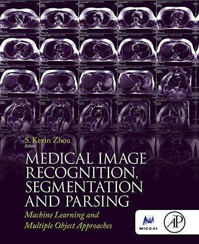 Medical Image Recognition, Segmentation and Parsing: Machine Learning and Multiple Object Approaches (The Elsevier and Miccai Society Book Series)