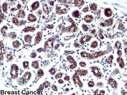 Estrogen Inducible Protein pS2 Antibody, Clone GE2 (aka clone R47/94), 100 ug (V2259-100UG)