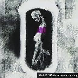 精神科医(拒食症)のスナッフフィルム集 <通常盤>