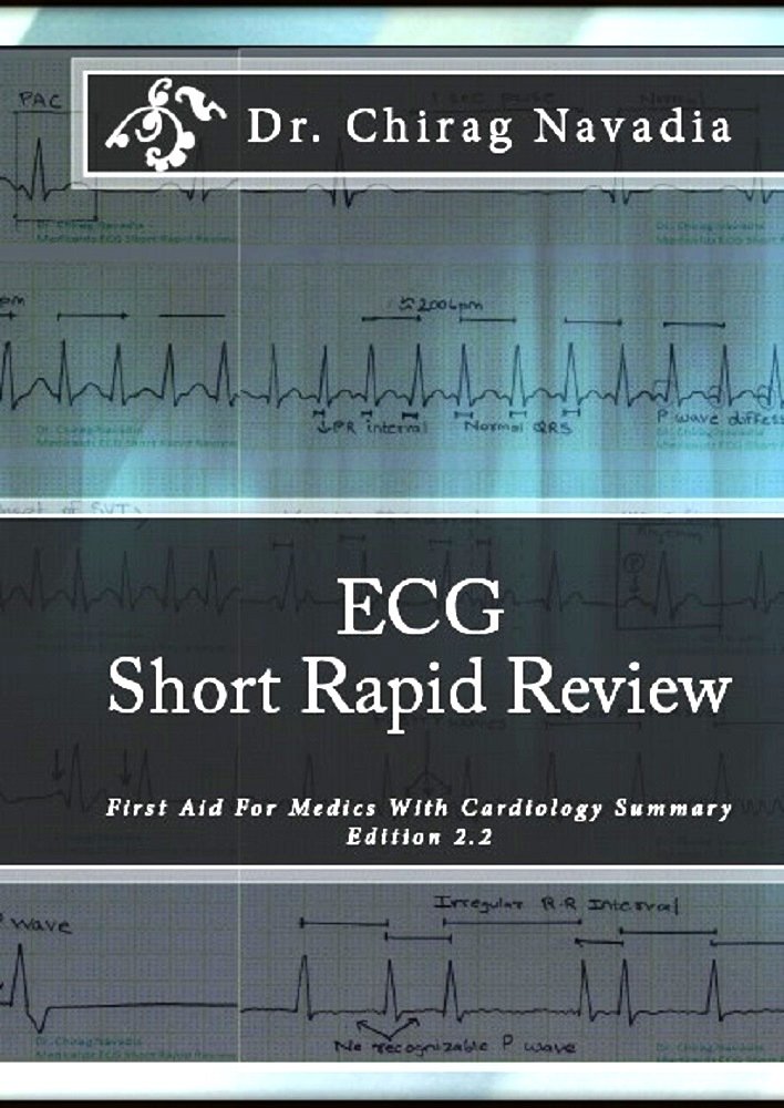 Amazon.com: ECG Short Rapid Review (Flashcards type) With ...